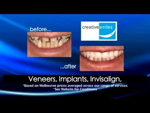 Creative Smiles HALF PRICE Cosmetic Dentistry melbourne Australia