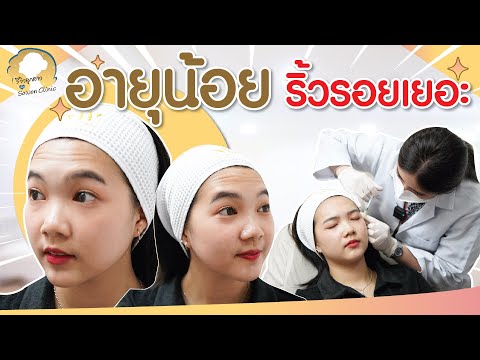 เมโสแฟต ยี่ห้อไหนดี