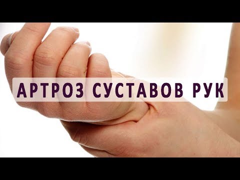 Какую купить мазь от болей в суставах Рентген коленного сустава в екатеринбурге