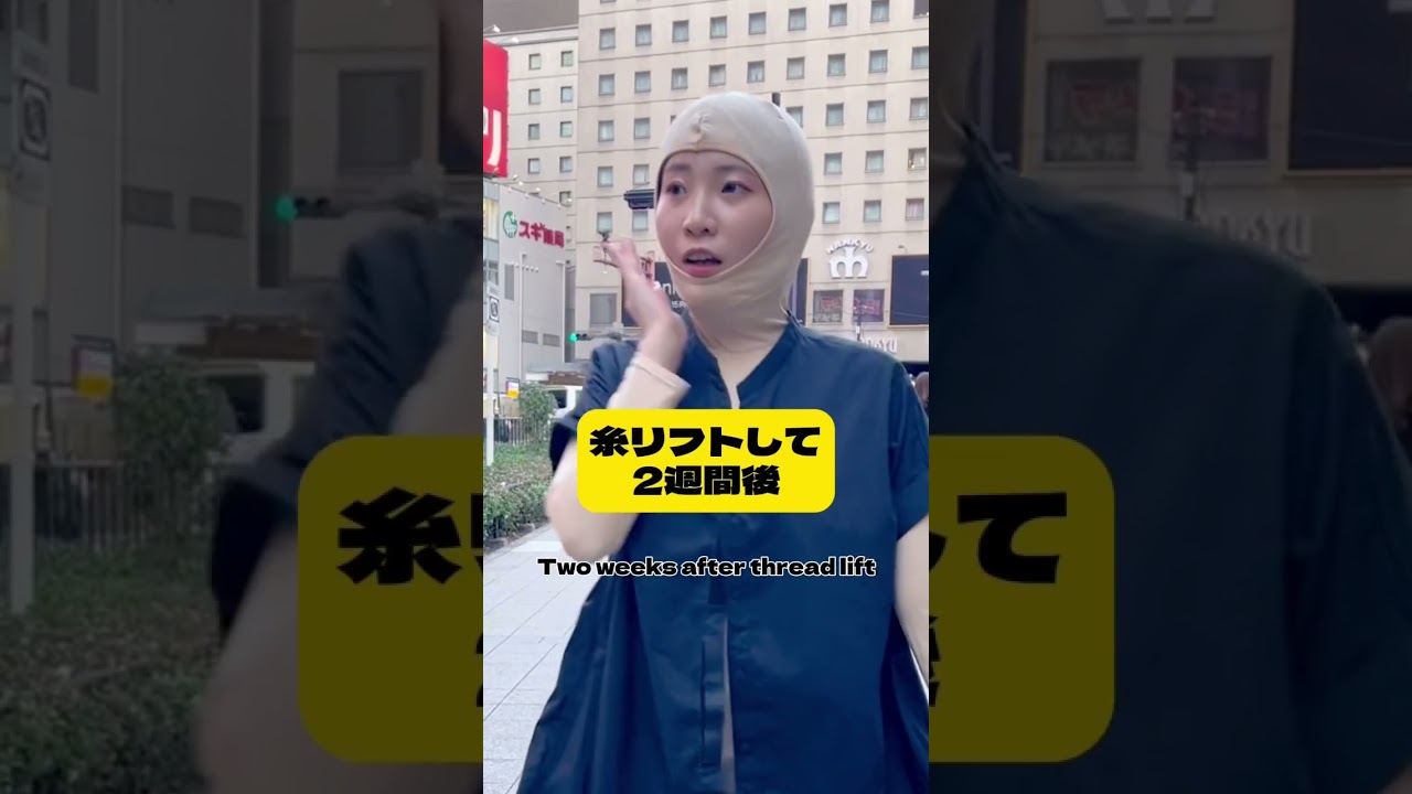 【糸リフト】全身タイツ女が小顔整形した結果…#shorts