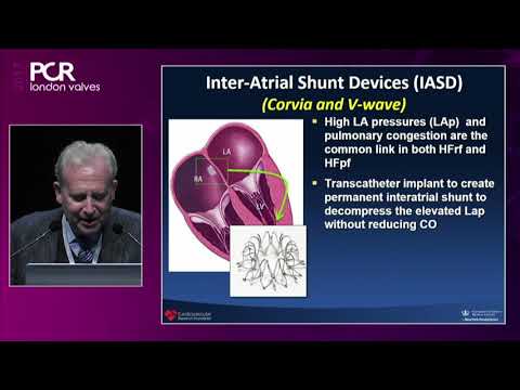 Going beyond boundaries in structural heart interventions?