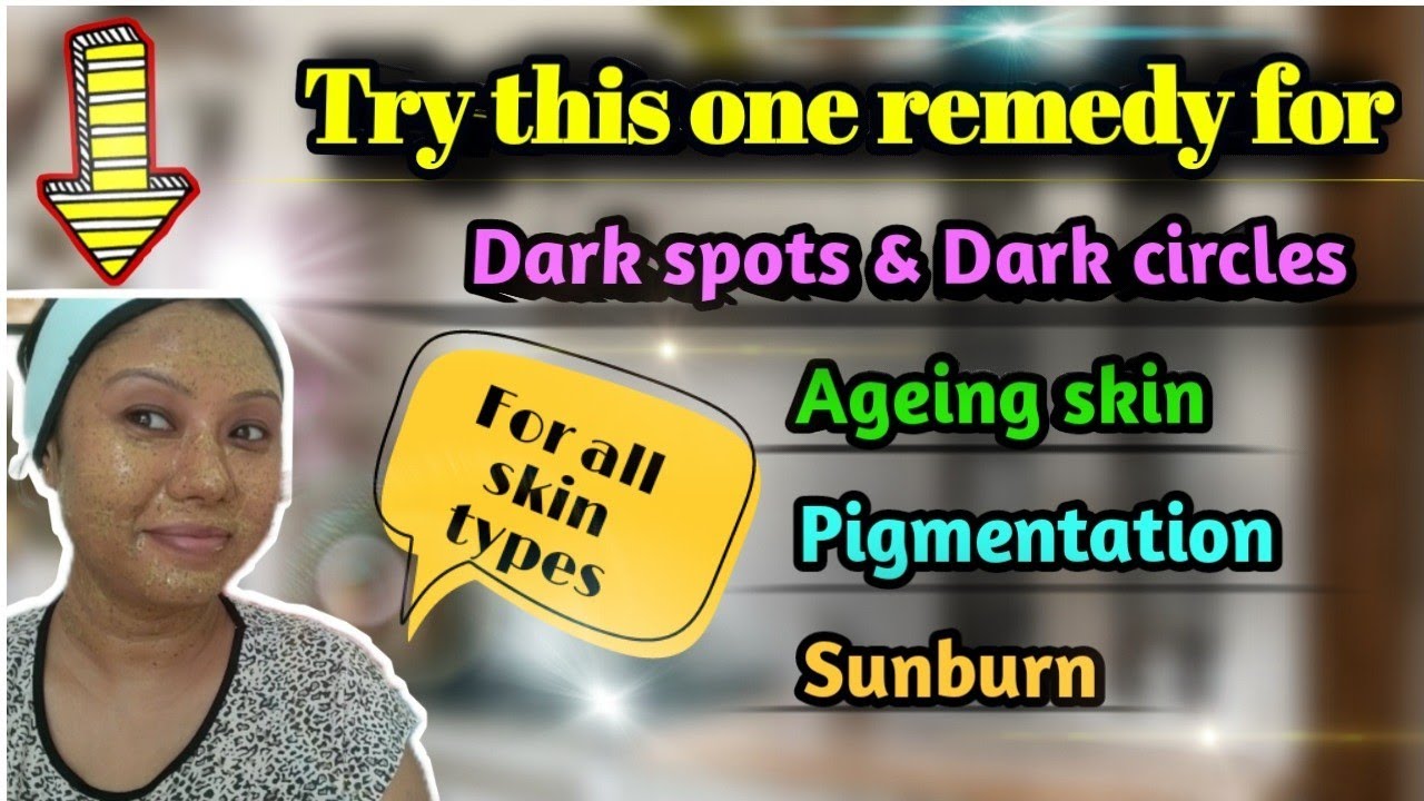 Resolve for Pigmentation, Sunburn,Tanning, Black Spots, Melasma, Getting older pores and skin || DIY resolve 2024 || thumbnail