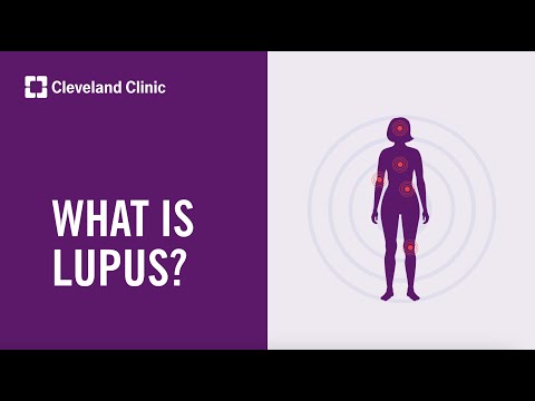 What Is Lupus?