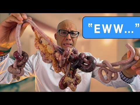 Don't get "tied" up in this.... Small Bowel Obstruction Explained!