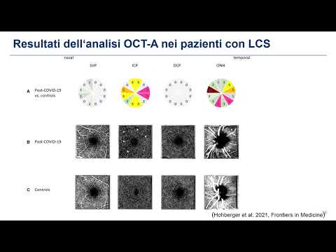Congresso  - Genetica delle collagenopatie — Prof.ssa F. Pasutto