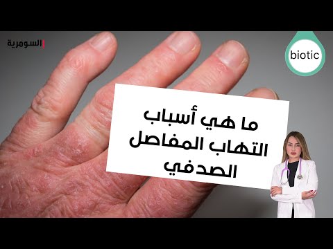 شاهد بالفيديو.. ما هي أسباب التهاب المفاصل  الصدفي