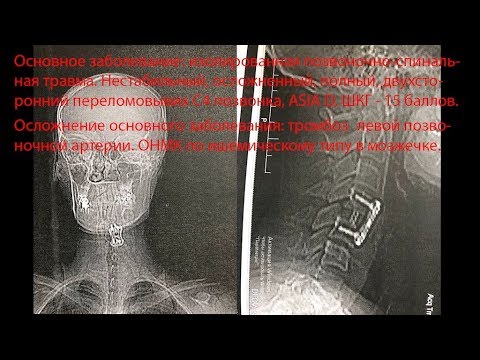 Причины болей во всех суставах Лечебная гимнастика для тазобедренных суставов ребенку