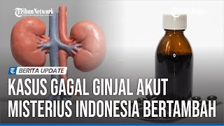 KEMENKES LARANG PEMBERIAN OBAT SIRUP ANAK, APOTEK DILARANG JUAL