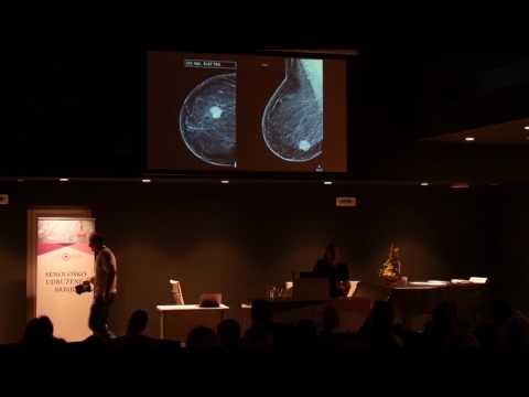 Prof. dr Dragana Bogdanović Stojanović- Savremeni radiološki protokol u dijagnostici karcinoma dojke