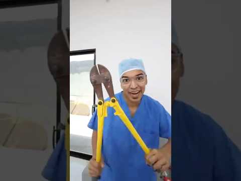 OPERARON A LARIN JR #comedia @alfredolarin