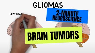 2-Minute Neuroscience: Brain tumors