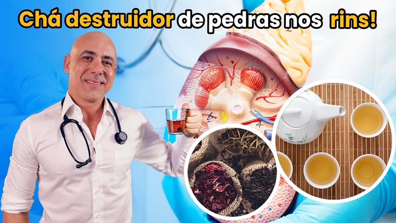 Chá Destruidor de Pedras nos Rins! Limpe seus Rins Naturalmente e Diga Adeus às Dores!