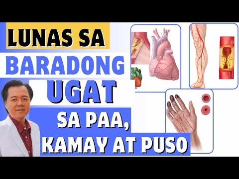 Lunas sa Baradong Ugat sa Paa, Kamay at Puso. - By Doc Willie Ong (Internist and Cardiologist)