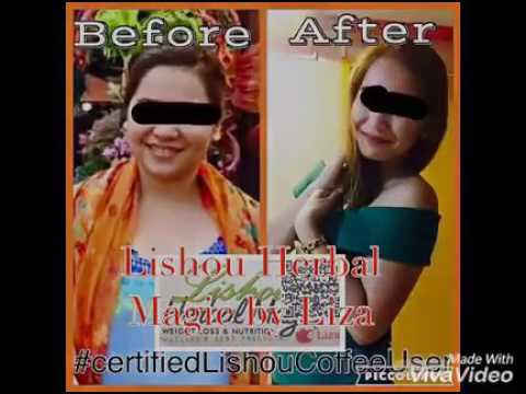 Silicone singsing na may isang magnet slimming bili Kung paano gamitin ang luya para sa pagbaba ng timbang contraindications