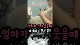 Download lagu 📣24만뷰📣엄마가 웃을 때, 태아에게 일어나는 놀라운 일! mp3