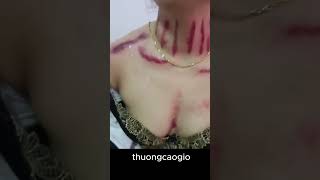 Download lagu thuong cao gio, giựt gió cổ trị bệnh gái đẹp mp3 Download lagu thuong cao gio, giựt gió cổ trị bệnh gái đẹp mp3