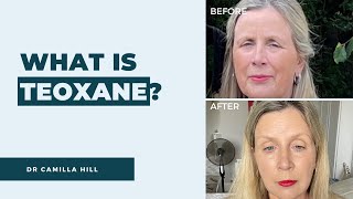 Why does Dr Camilla Hill use Teoxane in her facial aesthetics clinic? | Dr Camilla Hill