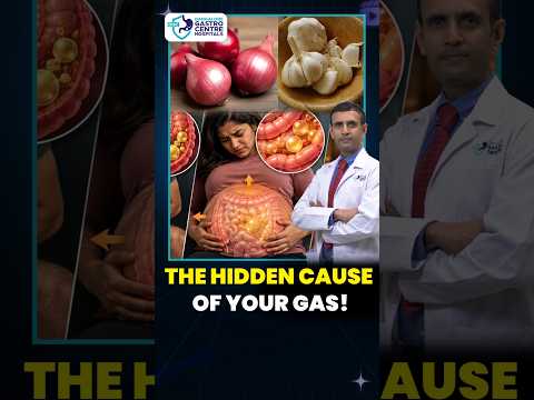 Onion & Garlic Making You Bloated? The Shocking Truth! 😱🧅