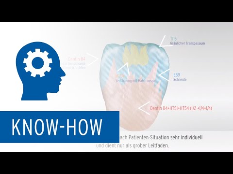 Zolid HT+ Preshades – Einfärbetutorial 16 aus 7 | High Esthetics Methode B2-B4