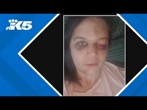 Renton transgender woman attacked near transit center; 2 teens arrested