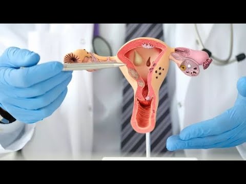 Men kijan medam yo ka evite kansè kòl matris !