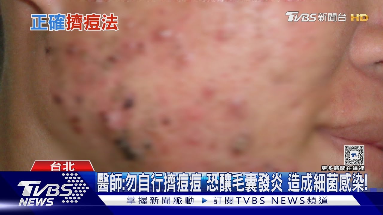 「這部位」發炎千萬別做「這件事」 醫師:細菌若入侵下場慘!