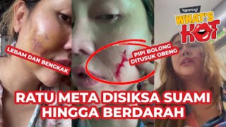 Download lagu Ratu Meta Unggah Bukti Alami KDRT Dari Sang Suami, Pipi Sampai Bolong Dan Berdarah mp3 Download lagu Ratu Meta Unggah Bukti Alami KDRT Dari Sang Suami, Pipi Sampai Bolong Dan Berdarah mp3