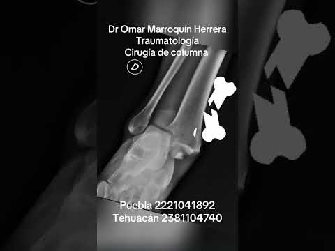 Omar Marroquín Herrera-91