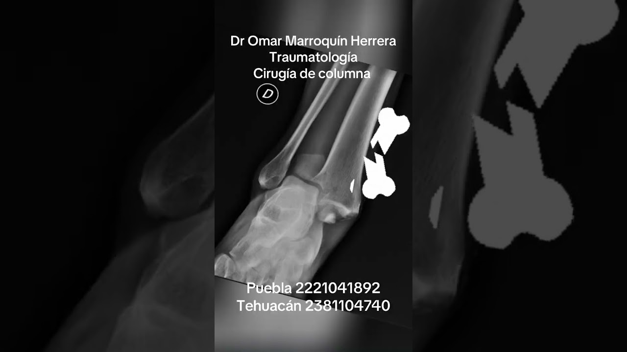 Omar Marroquín Herrera-91