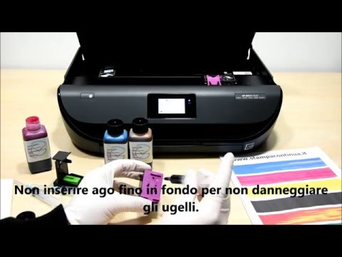 Articolazioni unguento muscoli Ð ± оР»Ñ NOE D² пинÐμ внуÑ, Ñ € D мÐμжÐу л опР° N, кР° ми