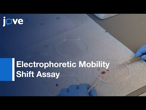 (EMSA): Study of RNA-Protein Interactions: The IRE/IRP Example