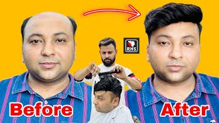 Hair Patch For Men | Hair Patch Work | Best Hair Patch Centre | Call Us 9599858612