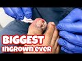 OMG HE SET A RECORD