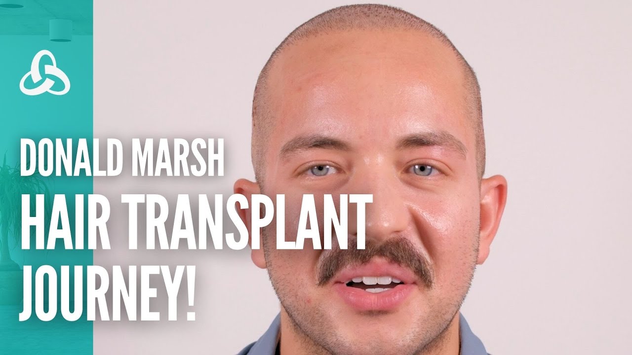 Rediscover Confidence with UniquEra Clinic Hair Transplant