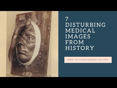 7 Disturbing Medical Images From History