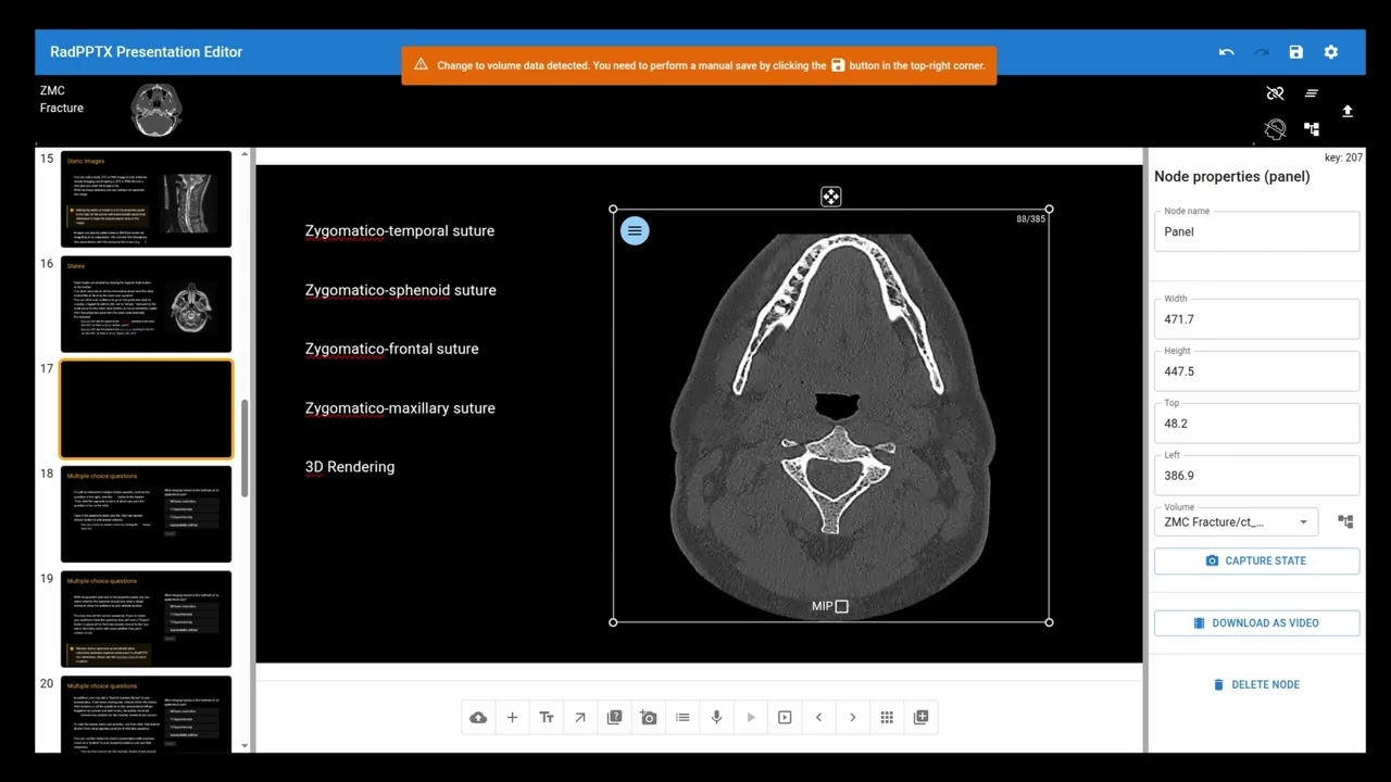 RadPPTX Tutorial: Using States