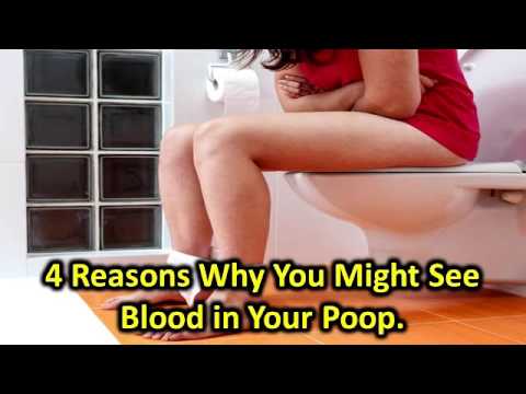download lagu mp3 mp4 Shitting Blood, download lagu Shitting Blood gratis, unduh video klip Shitting Blood