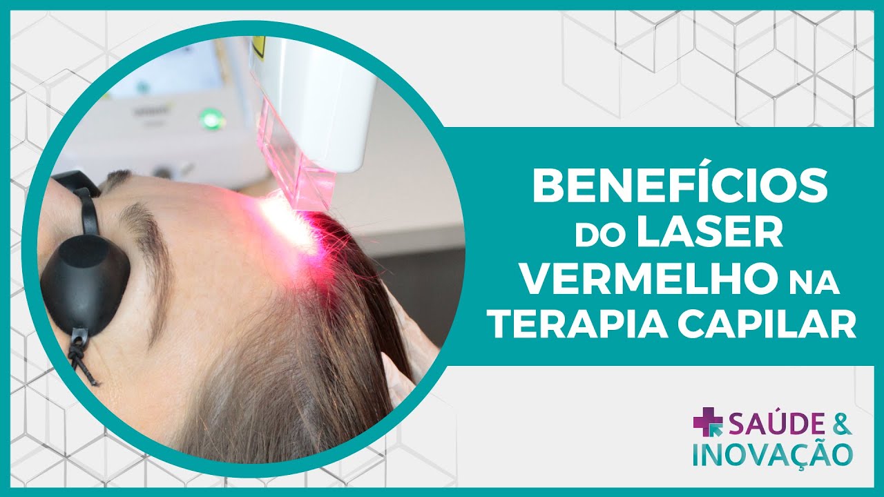 Benefícios do Laser Vermelho na Terapia Capilar