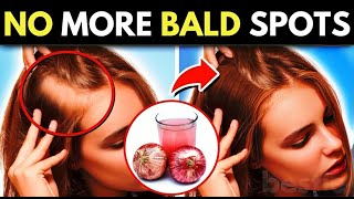 13 Ways To Regrow Your Hair Naturally And Forget About Bald Spots in  2024