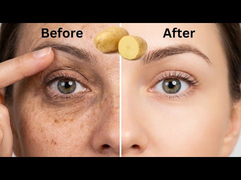 🔥 Shock! What Potato Juice Does to Your Facial Skin — 4 Masks That Really Work! 🍠