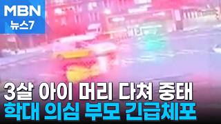3살 아이 머리 다쳐 중태…경찰, 부모 긴급체포 [MBN 뉴스7]
