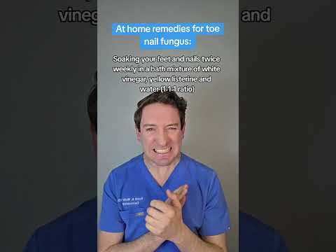 Dealing with toe nail fungus? (Onychomycosis) Here are some Derm backed Home Remedies! #nailfungus