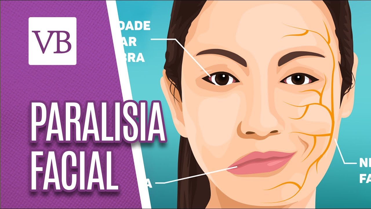 Paralisia facial - Você Bonita (23/01/19)