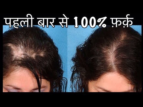 download lagu mp3 mp4 Cow Milk For Hair, download lagu Cow Milk For Hair gratis, unduh video klip Cow Milk For Hair