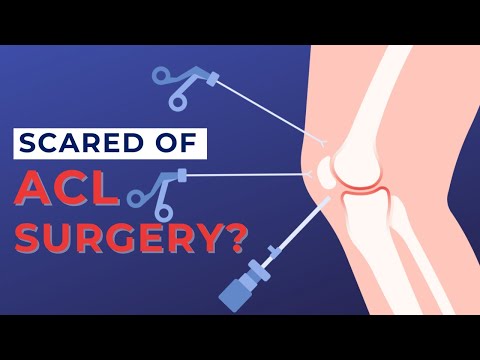 What is ACL Surgery Like? - My ACL Surgery Day Experience