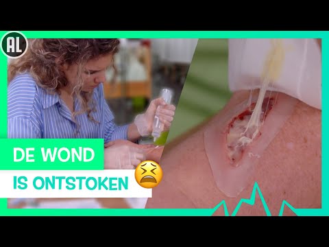 ZO MAAK JE EEN ONTSTOKEN WOND SCHOON! 🧼 | TOPDOKS | SPECIALISME