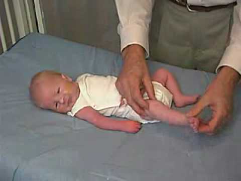 neurology exam: newborn-abnormal: Tone - Lower Extremity Tone