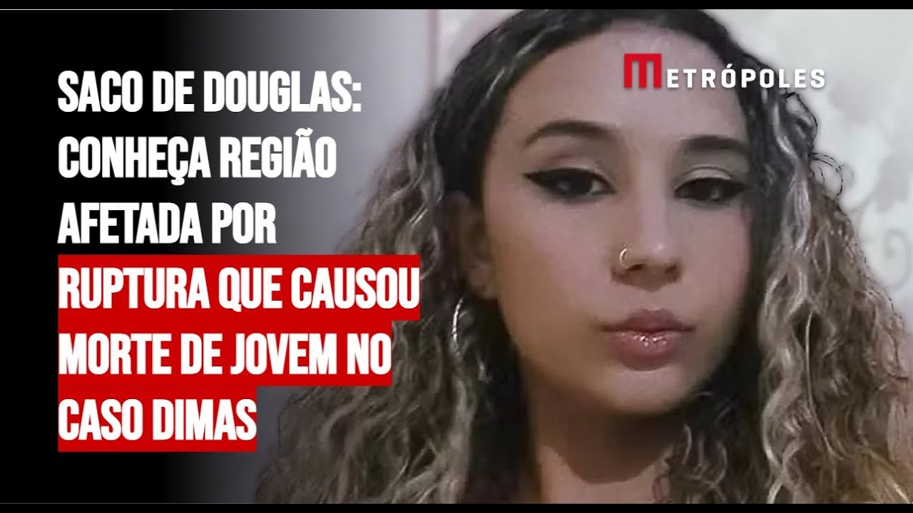 Saco de Douglas: conheça região afetada por ruptura que causou morte de jovem no caso Dimas