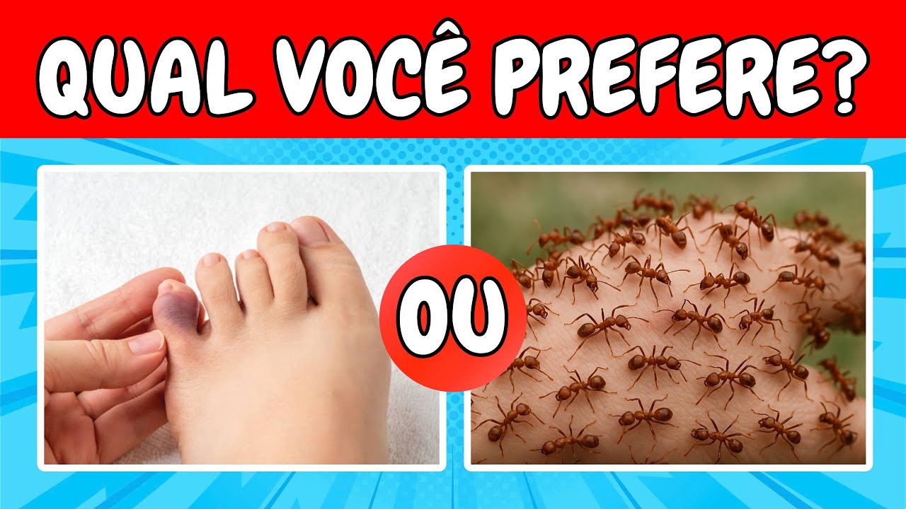 Qual Você Prefere??? 100 Escolhas mais Insanas de Todas 😯🤯😨