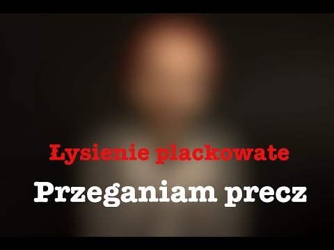 Olejki do włosów olej kokosowy Niż leczyć kota od łysienia